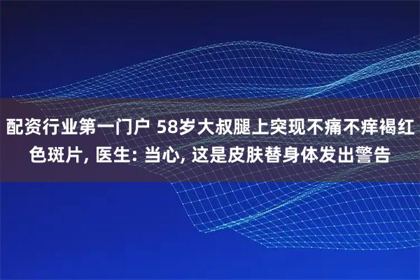 配资行业第一门户 58岁大叔腿上突现不痛不痒褐红色斑片, 医生: 当心, 这是皮肤替身体发出警告